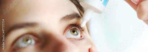 Woman applying eye drop. Vitamin drops from tiredness and redness eyes. Suffering from irritated eye, optical symptoms. photo