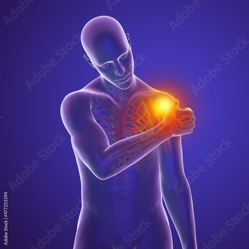 Shoulder pain, 3D illustration