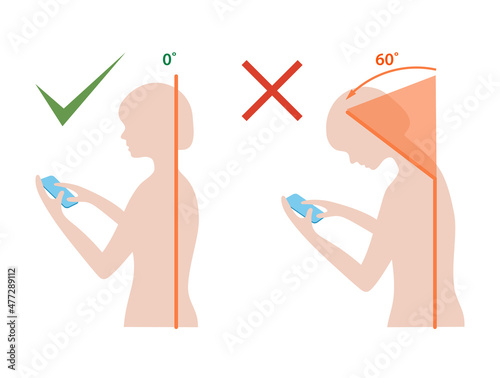 Computer neck syndrome