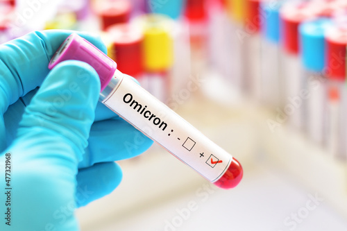 Omicron positive, blood sample tube positive with Omicron or B.1.1.529 variant of COVID-19 coronavirus photo