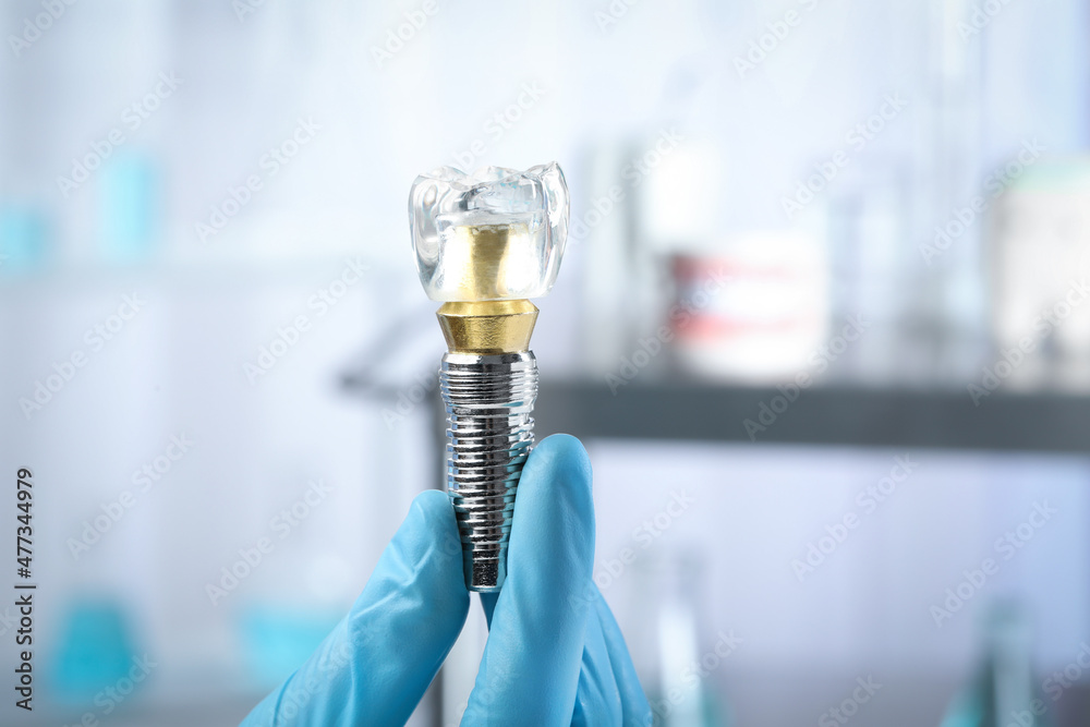 Dentist holding educational model of dental implant on blurred background, closeup Dentist holding educational model of dental implant on blurred background, closeup