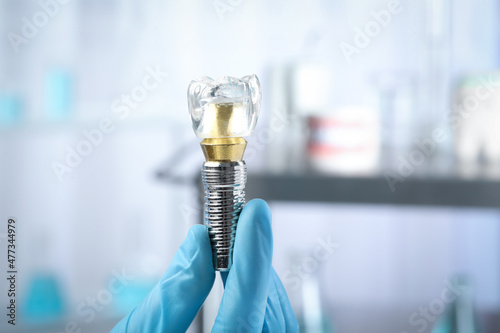 Dentist holding educational model of dental implant on blurred background, closeup