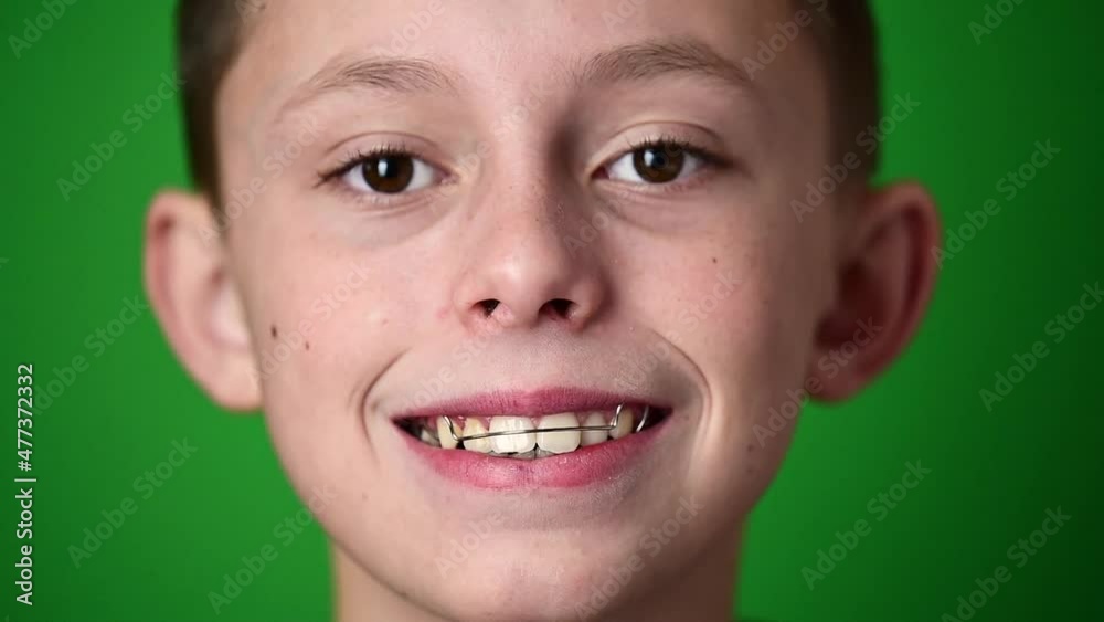 The child puts on a dental plate for alignment of crooked teeth, a portrait of the child on a green background. The child puts on a dental plate for alignment of crooked teeth, a portrait of the child on a green background.