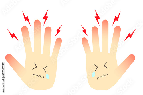 手荒れのイラスト。あかぎれ、しもやけ、手湿疹。