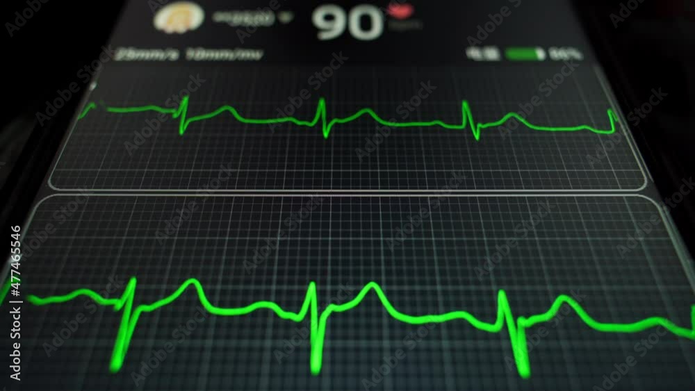 Home ECG measurement Home ECG measurement