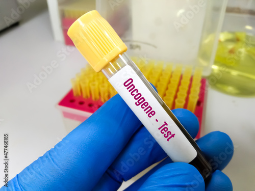 Blood sample tube for Oncogene test at medical laboratory. To diagnosis  cancer gene photo
