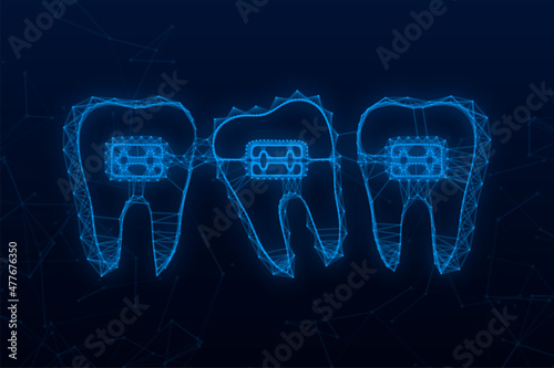 Correction of teeth with orthodontic braces. Stages of teeth alignment. Dental clinic services. Vector stock illustration