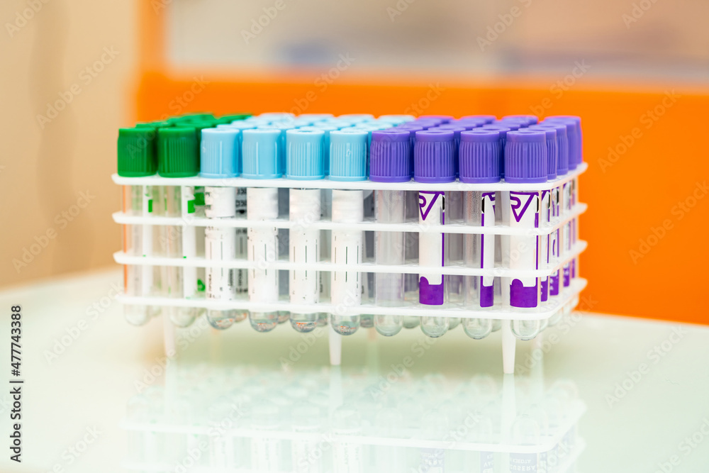 Close up view of blood test procedure in laboratory. Healthcare medicine concept.