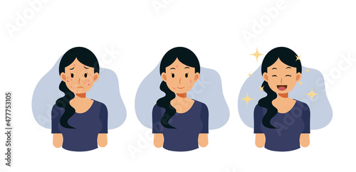 Acne concept.pimples. skin problems. step of Clear of acne.Flat vector cartoon character illustration.