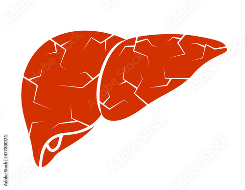 Damage liver. Health care concept. Vector illustration.