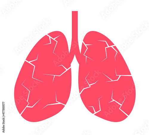 Pneumonia and lung cancer. Disease and illness is damaging internal organ in human body. Health problem based on infection, virus, bacteria, tumor and carcinoma. Vector illustration.