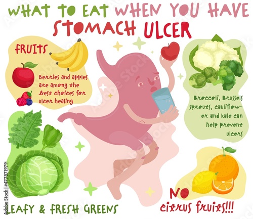 What to eat when you have stomach ulcer. Editable vector illustration