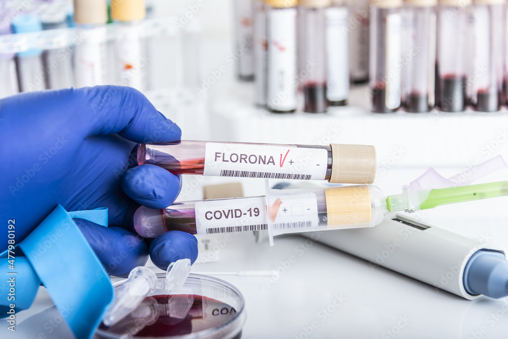 Doctor's hands hold blood samples of the new variant omicron plus flu FLORONA, covid19, coronavirus. Selective approach to the sample tube.