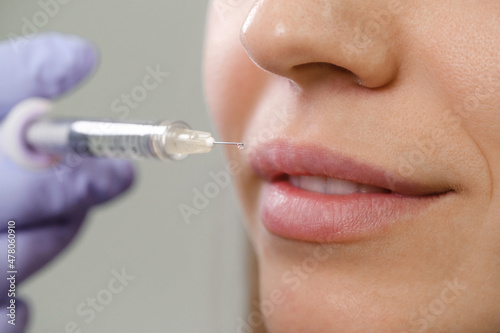 Quadro em tela Lips augmentation injections for attractive woman