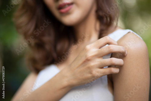 Asian woman scratching her arm skin, concept of dry skin, allergic dermis inflammation, fungus infection, dermatology disease, eczema, rash, skin care