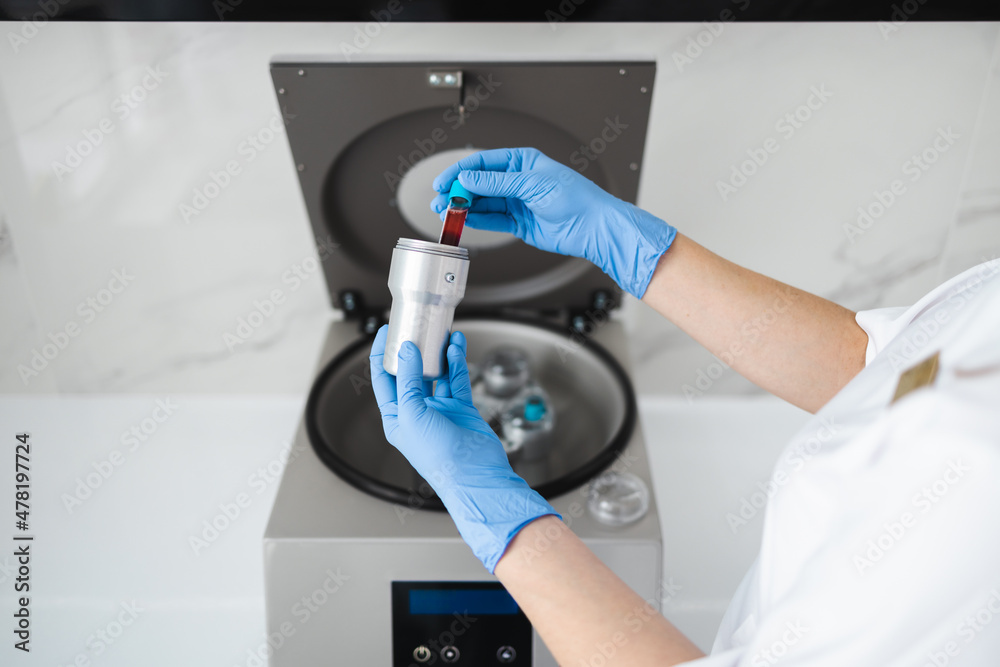 Beautician doctor's hands put test tube with blood in centrifuge container. Rejuvenation plasmolifting procedure Beautician doctor's hands put test tube with blood in centrifuge container. Rejuvenation plasmolifting procedure