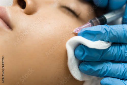 Young woman receiving beauty injection on her face, closeup