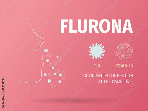 Flurona, simultaneously contagious of influenza and covid-19.