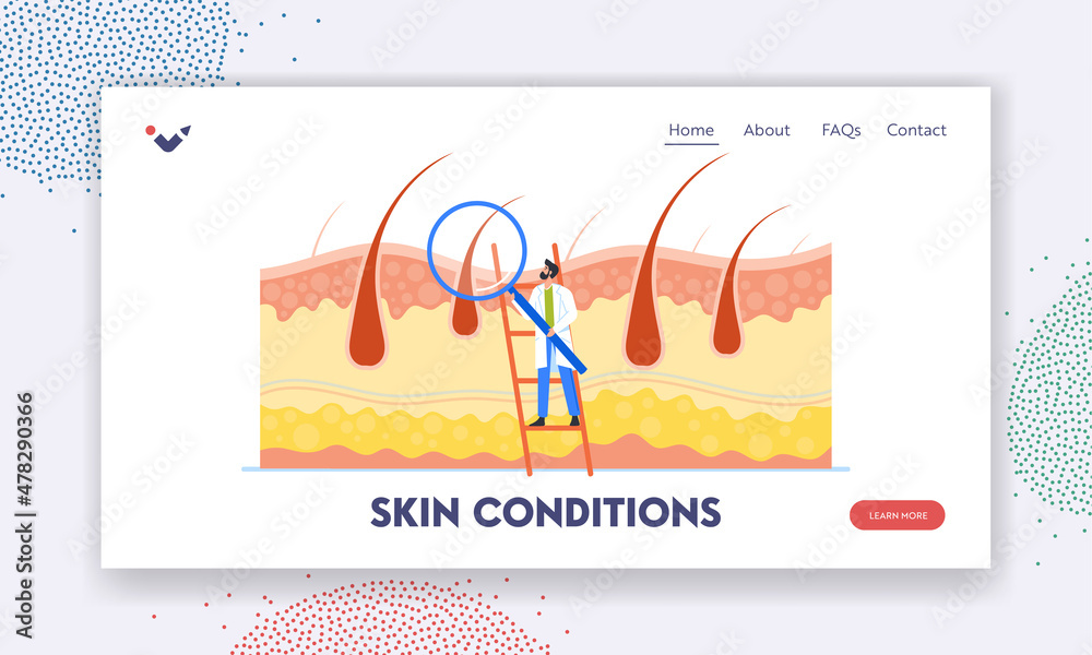 Skin Conditions Landing Page Template. Tiny Doctor Trichologist Check Health of Hair Follicles and Scalp with Magnifier