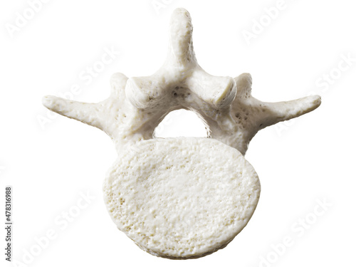 3d rendered illustration of a lumbar vertebrae photo