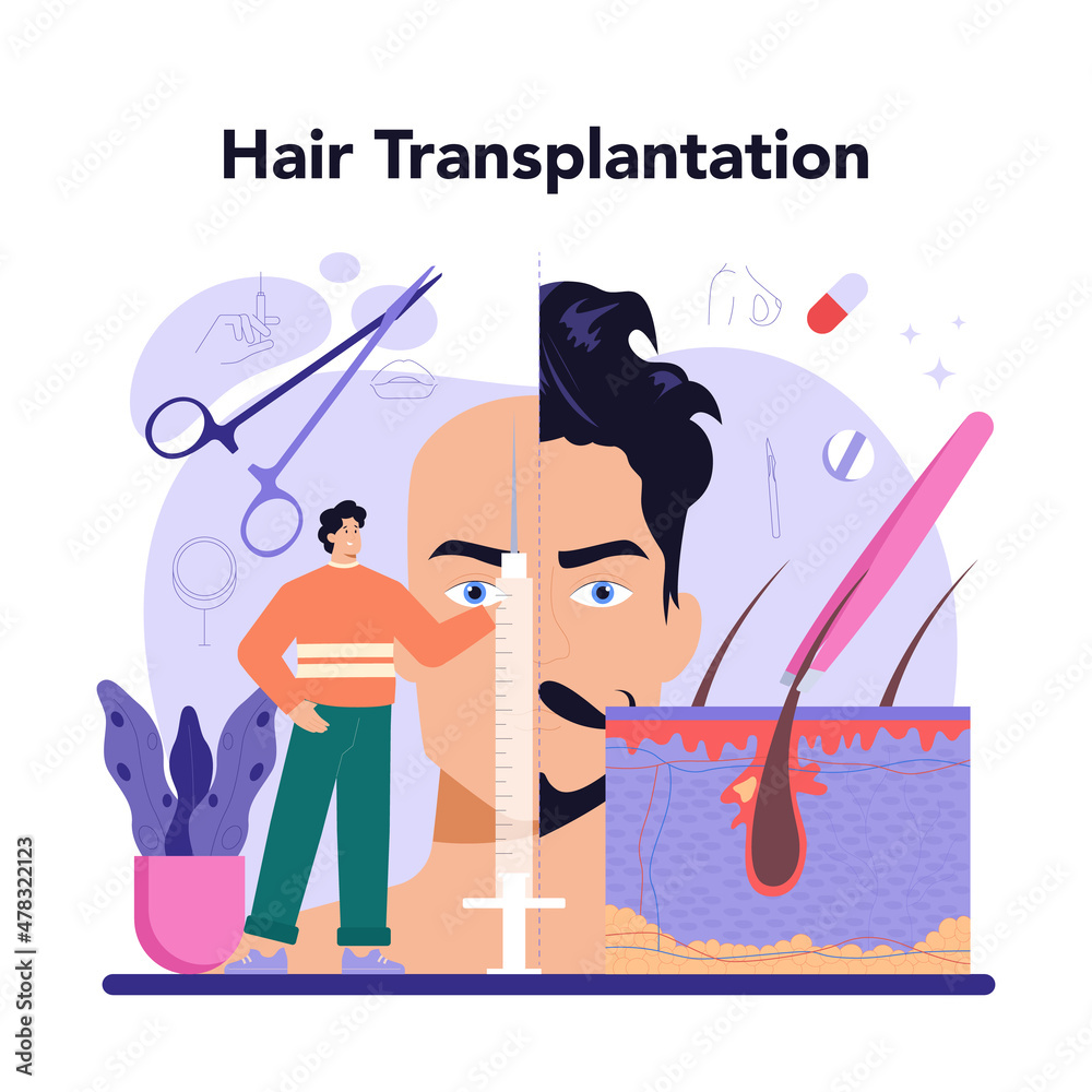 Plastic surgery concept. Idea of modern aesthetic medicine. Hair  transplantation Stock Vector | Adobe Stock