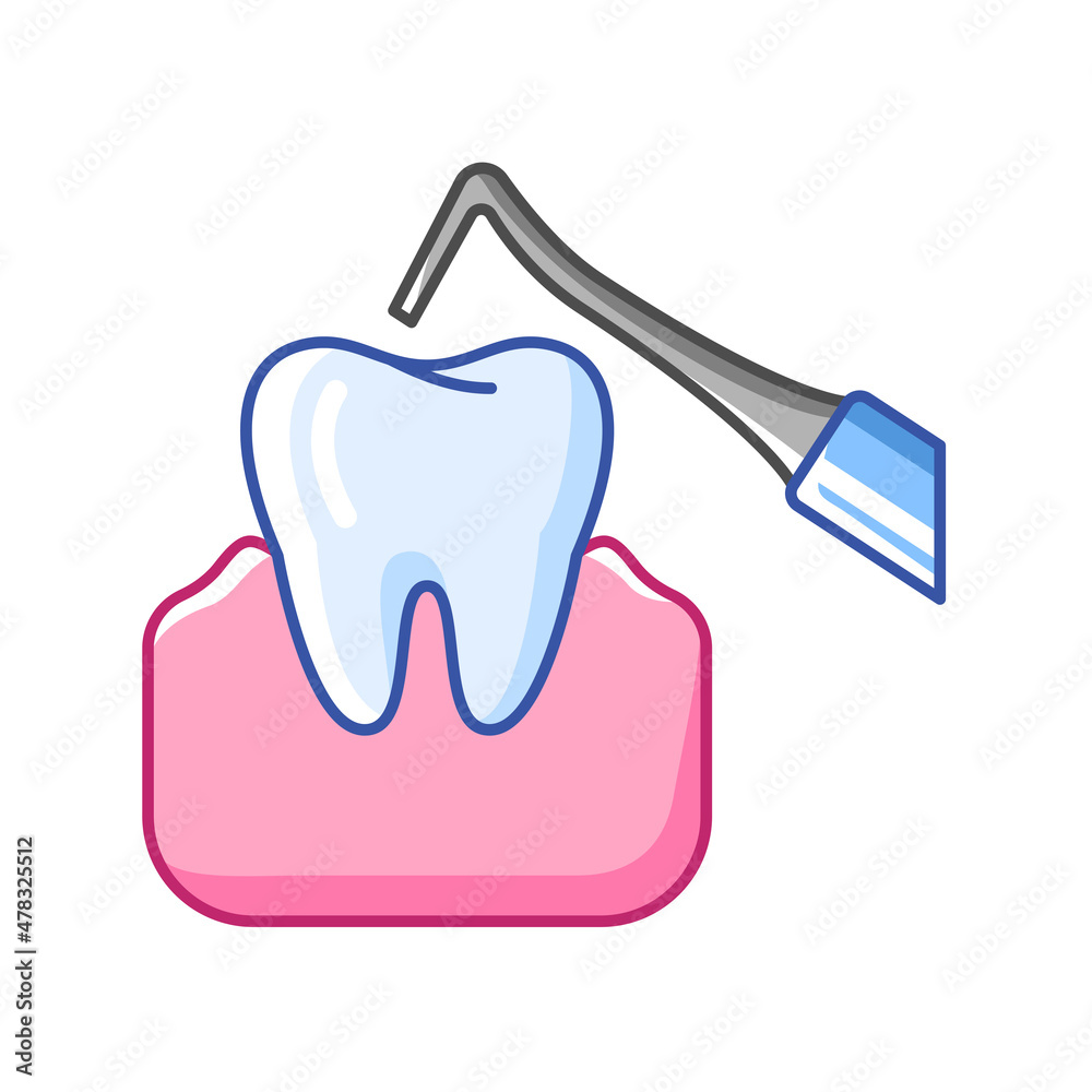 Illustration of dental hook treatment. Dentistry and health care icon. Stomatology medical item. Illustration of dental hook treatment. Dentistry and health care icon. Stomatology medical item.