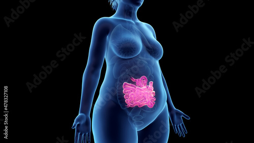 3d rendered illustration of an obese womans small intestine