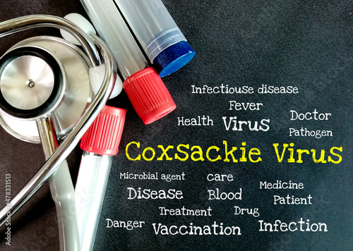 coxsackie virus words on blackboard with medical tools. coxsackie virus disease concept photo