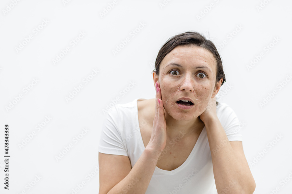 Photo of shocked woman because of her skin problems. Photo of shocked woman because of her skin problems.