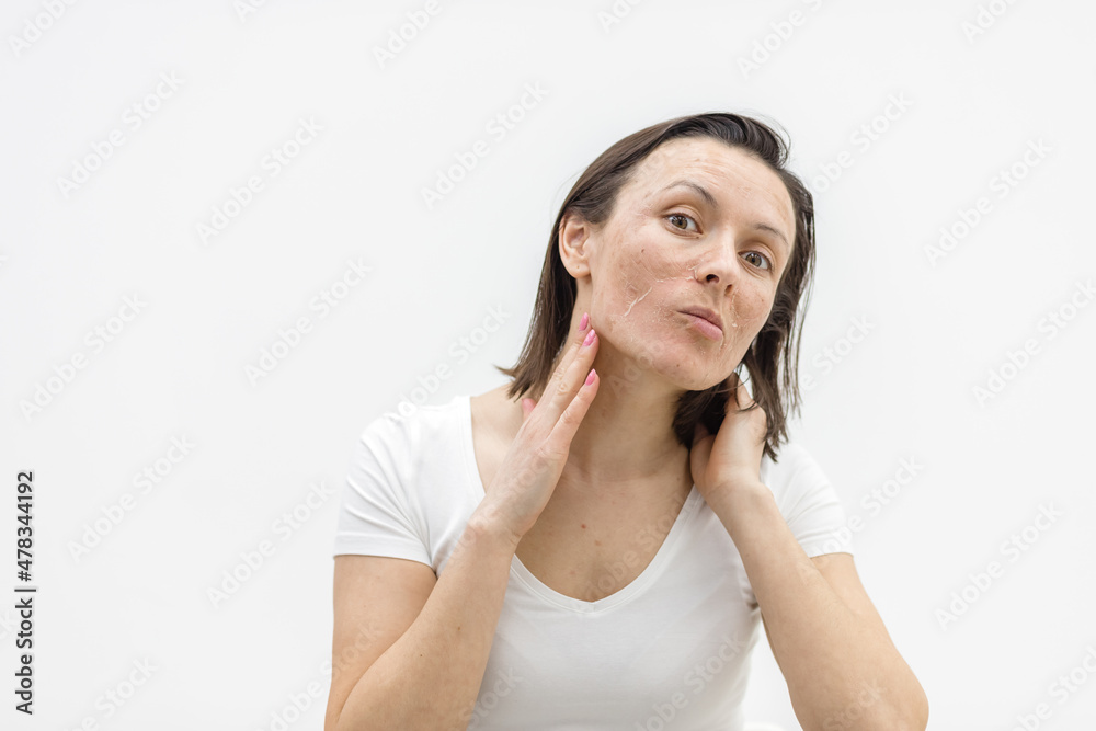 Photo of woman with dry skin touching her face on white background. Photo of woman with dry skin touching her face on white background.