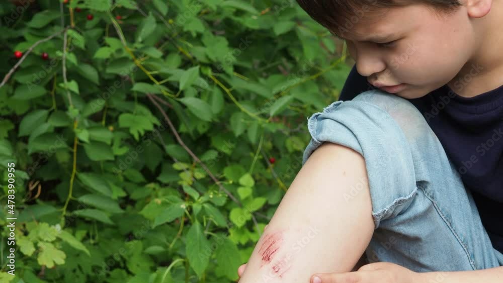 Video „Closeup of injured young kid's knee after he fell down on