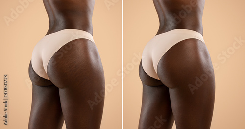 Before and after collage, black woman buttocks