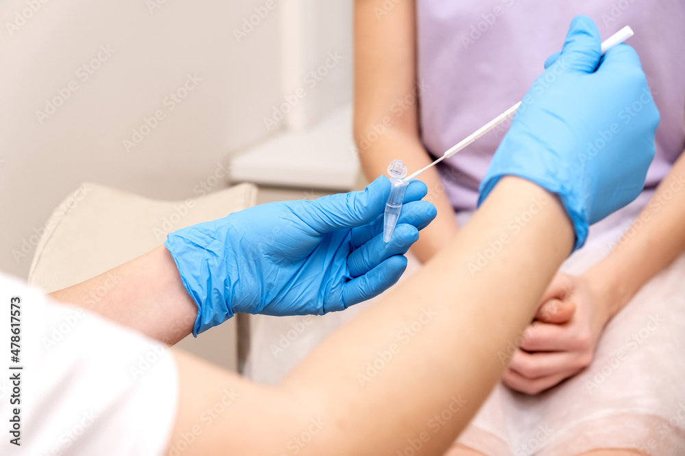 The gynecologist takes a sample of biomaterial from the patient's urogenital tract for PCR examination,hands close- up.Women's health, medical concept.