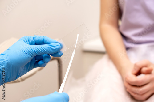 The gynecologist puts a smear on a slide glass for microscopy, hands close-up.Diagnosis of diseases of the genitourinary system.Women's health, medical concept.Selective focus. photo