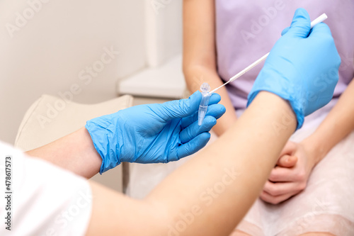 The gynecologist takes a sample of biomaterial from the patient's urogenital tract for PCR examination,hands close- up.Women's health, medical concept. photo