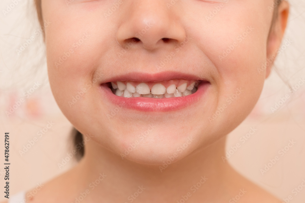 Obraz premium A little girl shows her teeth. Closeup of kid mouth.