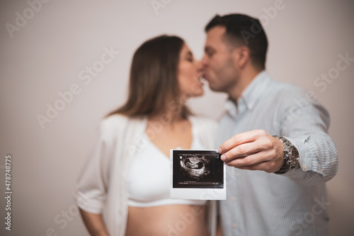 a couple kisses while teaching an ultrasound of their first child to the camera.