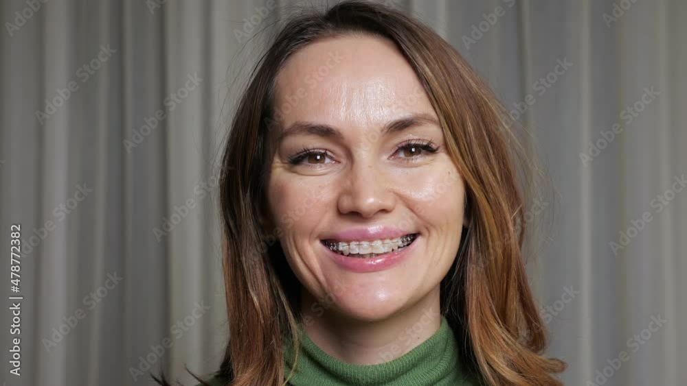 Portrait of young brunette woman in green sweater with dental braces on teeth smiling widely against beige curtain at home closeup. Portrait of young brunette woman in green sweater with dental braces on teeth smiling widely against beige curtain at home closeup.