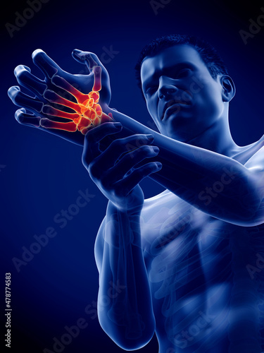 3d rendered medically accurate illustration of a man having a painful wrist