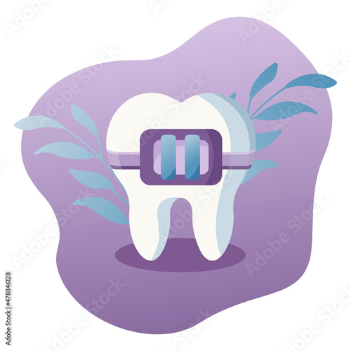 Flat modern illustration of tooth with braces. 
