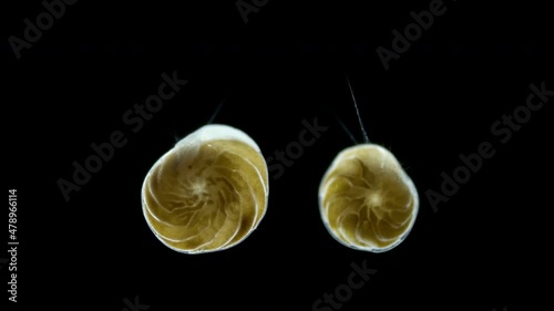 Foraminifera under a microscope, class Rotaliata, possibly order Rotaliida. Protista have a mineral shell. Shows movement of pseudopodia with which she captures food photo