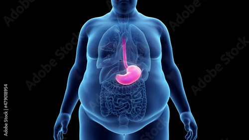 Canvastavla 3d rendered illustration of an obese mans stomach