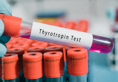 Hypothalamus Thyrotropin releasing hormone  TRH Test Regulates thyroid stimulating hormone release in the pituitary gland photo