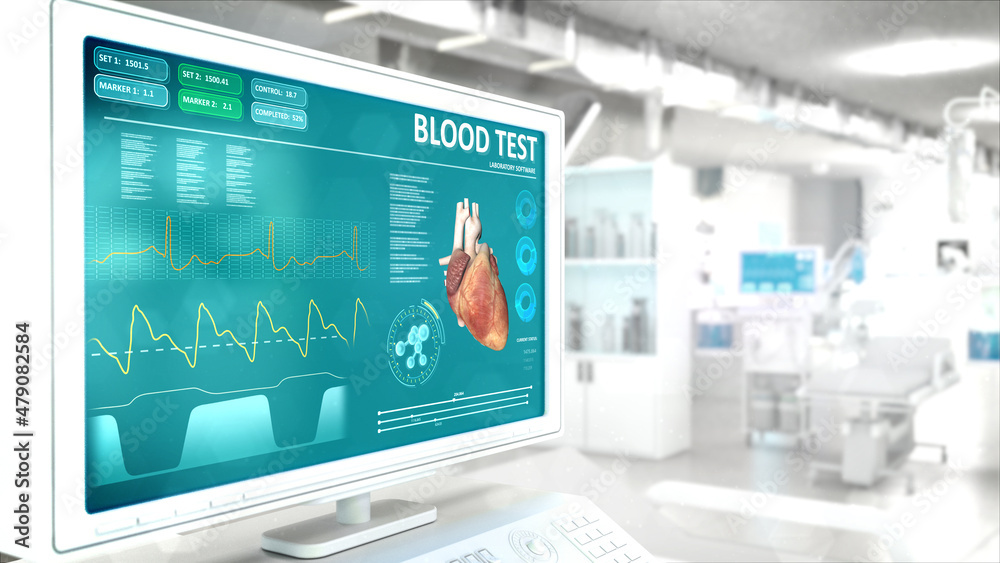 test of blood on monitor in high tech clinic room , computer generated industrial 3D rendering