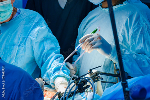 Close-up of the hands of surgeons in gloves in the operating room. Selective focus. A catheter for suctioning blood in the surgeon's hand during surgery. photo