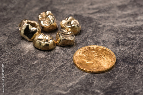 Fotografía Goldzähne / Kronen / Zahnersatz und Vreneli Goldmünze Schweiz 20 FR - Schweizer