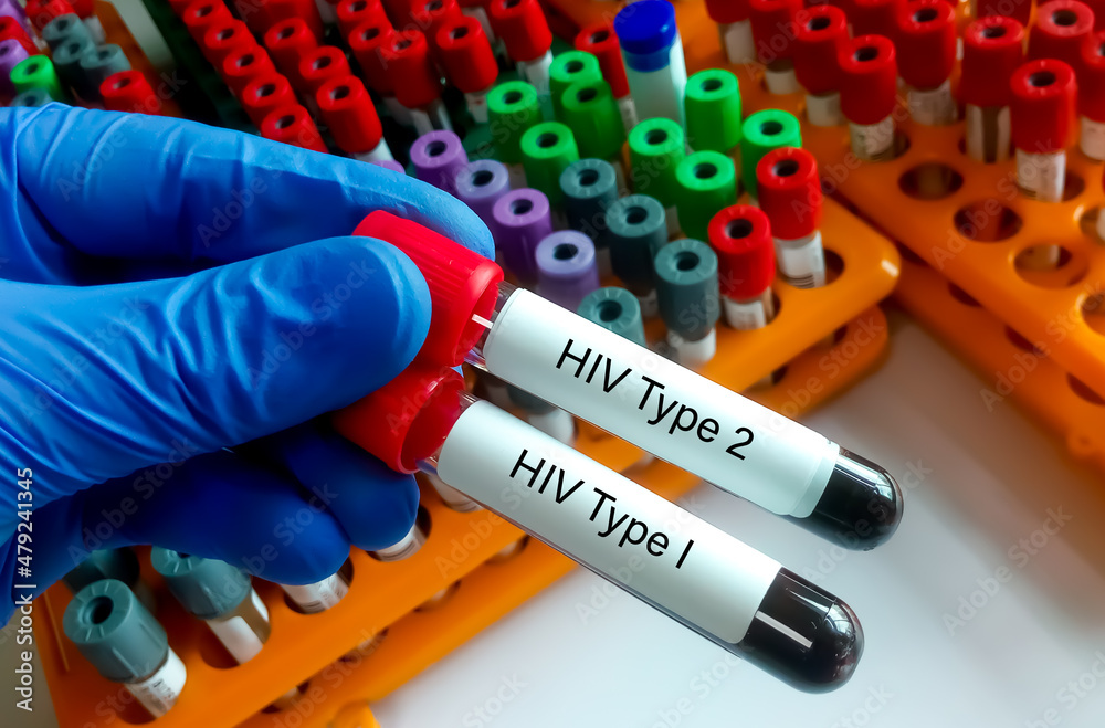 Obraz premium Scientist hold two test tube with blood sample for HIV type 1 and HIV type 2 antibody testing, hiv screening test