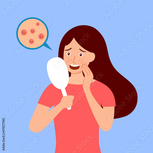 Young woman hand mirror worrying about her acne on face in flat design. Pimple problem on female skin.