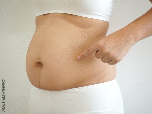Woman pointing to spots with cellulite overweight female body on white background. closeup photo, blurred.