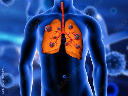 3D medical background with close up of lungs being attacked by Covid 19 virus cells